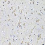 EEF1B2 Polyclonal Antibody