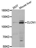 CLCN1 Polyclonal Antibody