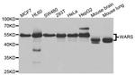 WARS Polyclonal Antibody