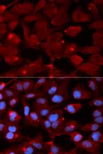 SMARCB1 Polyclonal Antibody