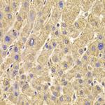 PEX5 Polyclonal Antibody