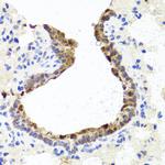 TOPBP1 Antibody in Immunohistochemistry (Paraffin) (IHC (P))