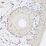 ETV4 Antibody in Immunohistochemistry (Paraffin) (IHC (P))