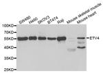 ETV4 Antibody in Western Blot (WB)