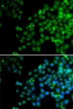 EPC1 Polyclonal Antibody