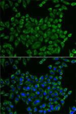 MRPS30 Polyclonal Antibody
