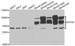 SP100 Antibody in Western Blot (WB)