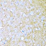 WNT2 Antibody in Immunohistochemistry (Paraffin) (IHC (P))