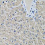 eIF2 gamma Antibody in Immunohistochemistry (Paraffin) (IHC (P))
