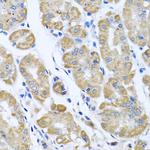 eIF2 gamma Antibody in Immunohistochemistry (Paraffin) (IHC (P))