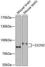 CLCN2 Polyclonal Antibody