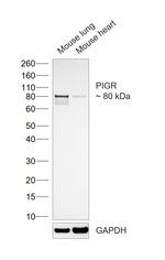 PIGR Antibody