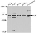 PIGR Polyclonal Antibody