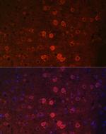 TRPM2 Polyclonal Antibody