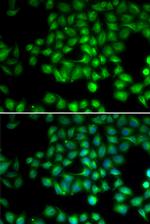 TRPM2 Antibody in Immunocytochemistry (ICC/IF)