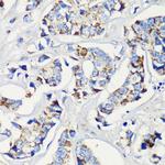 KMT2E Polyclonal Antibody