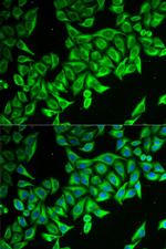 DAP Polyclonal Antibody