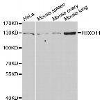 FBXO11 Polyclonal Antibody