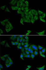 SMYD5 Polyclonal Antibody