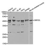 SMYD5 Antibody in Western Blot (WB)
