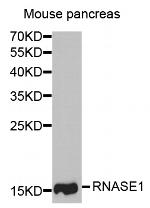 RNase1 Polyclonal Antibody