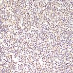 TIA-1 Polyclonal Antibody