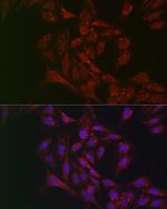 ATGL Polyclonal Antibody