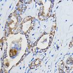 CYP51A1 Polyclonal Antibody