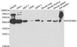 SERPINB1 Antibody in Western Blot (WB)