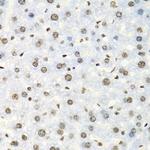 IGF2BP2 Antibody in Immunohistochemistry (Paraffin) (IHC (P))