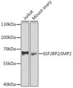 IGF2BP2 Antibody in Western Blot (WB)