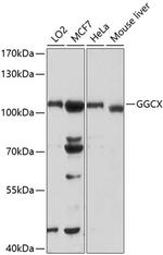 GGCX Polyclonal Antibody