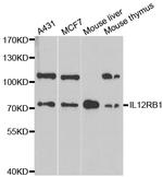 IL12RB1 Polyclonal Antibody