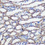 SND1 Polyclonal Antibody
