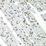 SF3B2 Antibody in Immunohistochemistry (Paraffin) (IHC (P))