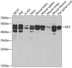 ILF2 Polyclonal Antibody