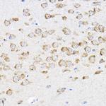 RPL4 Polyclonal Antibody