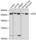 CHD2 Polyclonal Antibody