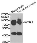 KV1.2 (KCNA2) Antibody in Western Blot (WB)