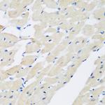 Pleckstrin Polyclonal Antibody