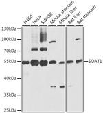 SOAT1 Polyclonal Antibody