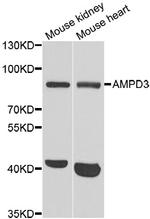 AMPD3 Polyclonal Antibody