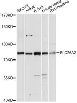 SLC26A2 Polyclonal Antibody