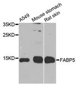 FABP5 Polyclonal Antibody