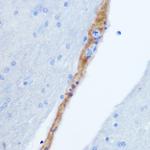 Bombesin Antibody in Immunohistochemistry (Paraffin) (IHC (P))