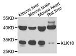 Kallikrein 10 Polyclonal Antibody