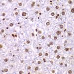 SSRP1 Antibody in Immunohistochemistry (Paraffin) (IHC (P))