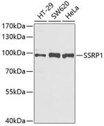 SSRP1 Antibody in Western Blot (WB)