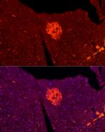 TSPAN7 Polyclonal Antibody
