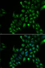 TSPAN7 Antibody in Immunocytochemistry (ICC/IF)